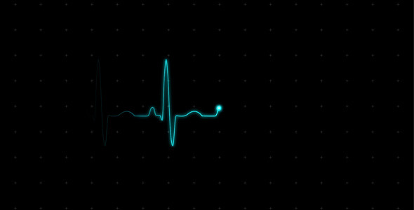 Free Heart Monitor Animation